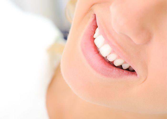 Răng Implant có màu sắc tự nhiên tương đồng với răng thật